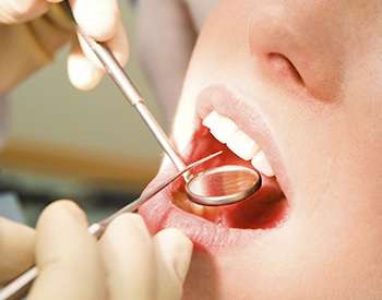 A brunette woman in pain massaging her sore jaw